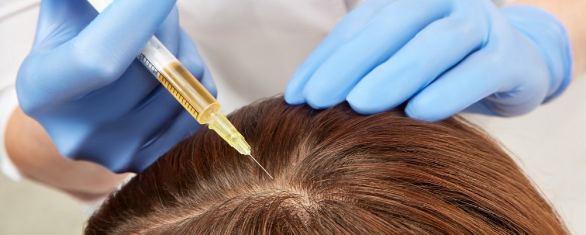 Platelets Rich Plasma injection for Hair Loss - BHI Clinic