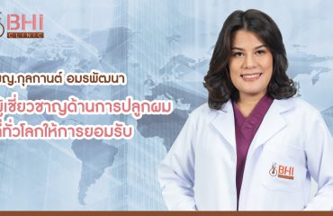 ้hairtransplant