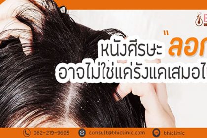 bhiclinic_hair