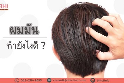 ผมมันทำไงดี
