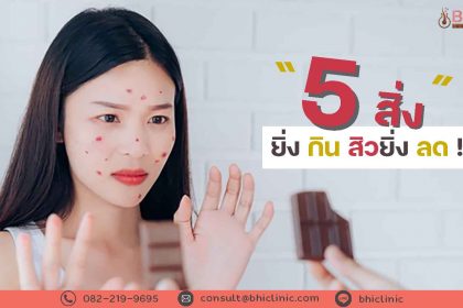 5-สิ่ง-ยิ่งกินสิวยิ่งลด